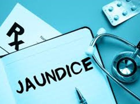 jaundice