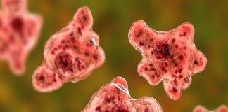Amoeba disease