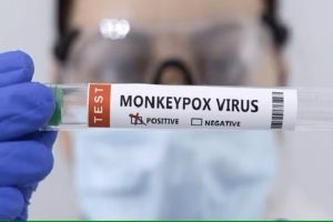 MPOX Virus