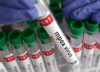 mpox