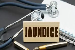 jaundice