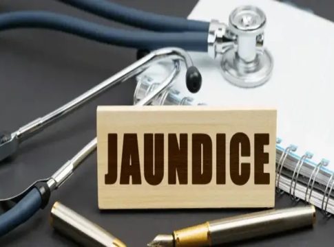 jaundice
