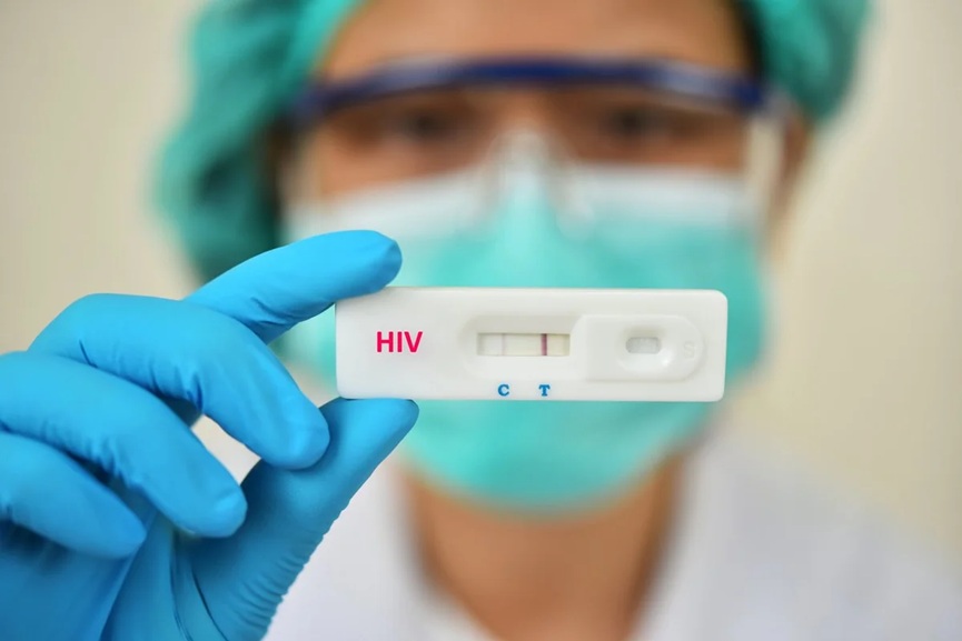 HIV HIV Outbreak