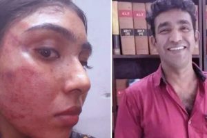 Lawyer Assault Case