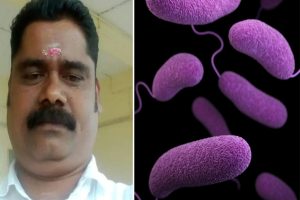 Cholera Death