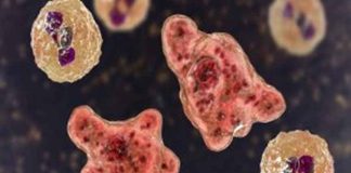 Amoeba disease