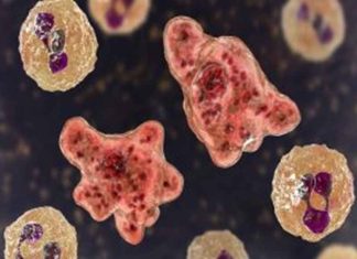 Amoeba disease