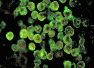 കൊച്ചിയിലും അമീബിക് മസ്തിഷ്ക ജ്വരം സ്ഥിരീകരിച്ചു; രോഗി ലക്ഷദ്വീപ് സ്വദേശി Amoebic Encephalitis