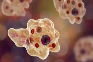  Amoebic Encephalitis