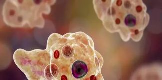  Amoebic Encephalitis