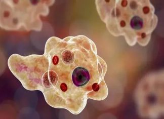  Amoebic Encephalitis