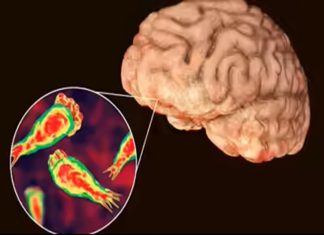 സംസ്ഥാനത്ത് ഒരാൾക്ക് കൂടി അമീബിക് മസ്തിഷ്ക ജ്വരം സ്ഥിരീകരിച്ചു Amoeba disease