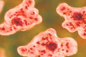 Amoebic Encephalitis in Kozhikode