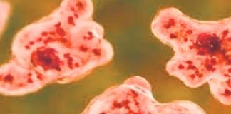 Amoebic Encephalitis in Kozhikode