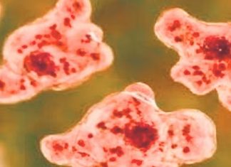 Amoebic Encephalitis in Kozhikode