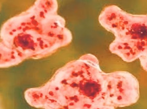 Amoebic Encephalitis in Kozhikode
