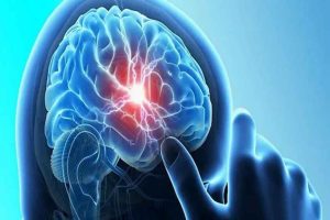 meningoencephalitis 