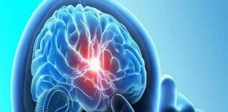 meningoencephalitis 