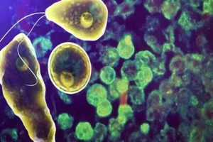 Amoebic Meningoencephalitis Kerala