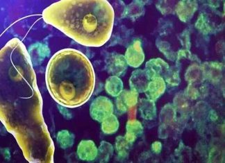 Amoebic Meningoencephalitis Kerala