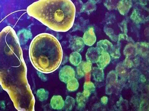 Amoebic Meningoencephalitis Kerala