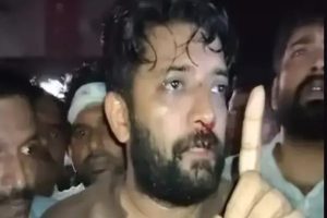 Perambra Clash-Shafi Parambil MP Injured
