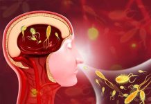 Amoebic meningoencephalitis
