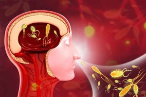 Amoebic meningoencephalitis