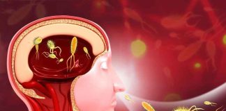 Amoebic meningoencephalitis