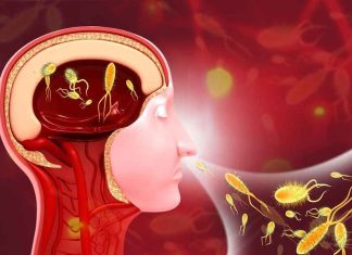 Amoebic meningoencephalitis