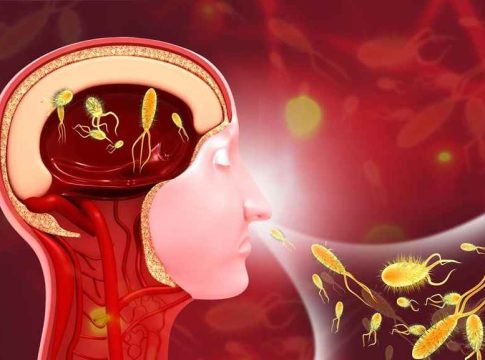Amoebic meningoencephalitis