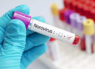 Noro virus