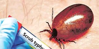 Scrub Typhus