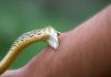 snake bite