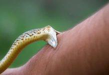 snake bite