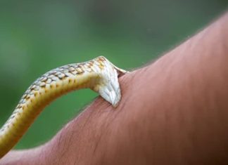 snake bite
