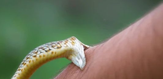 snake bite