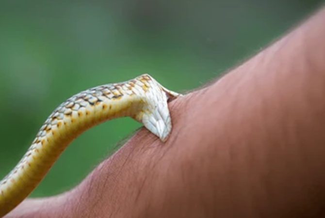 snake bite