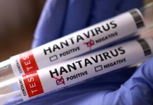 Hanta Virus Outbreak