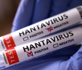 Hanta Virus Outbreak