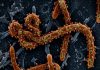 Ebola disease