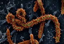 Ebola disease