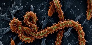 Ebola disease