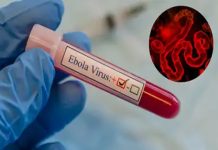 Ebola Virus