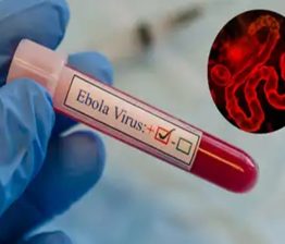 Ebola Virus