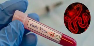 Ebola Virus