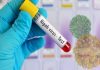 Nipah Virus
