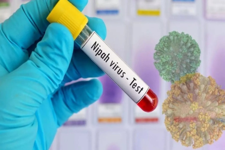 Nipah Virus Nipah Virus