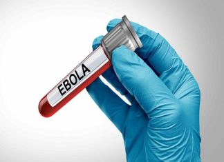 Ebola Virus