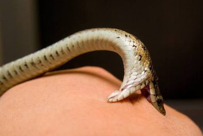 snake bite
